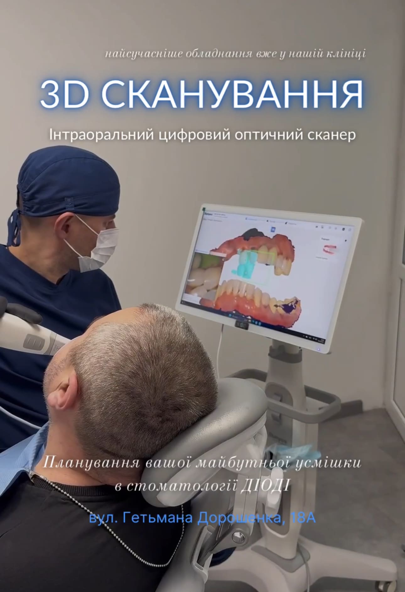 3D сканування у клініці «ДіОДі»